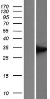 UCP1 Human Over-expression Lysates NM_021833