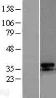 UCP3 Human Over-expression Lysates NM_003356