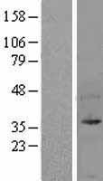 UFD1 Human Over-expression Lysates NM_005659