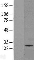 SLC35A2 Human Over-expression Lysates NM_001032289