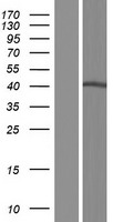 SLC35A2 Human Over-expression Lysates NM_005660