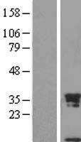 Uteroglobin (SCGB1A1) Human Over-expression Lysates NM_003357