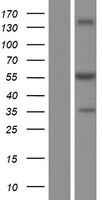 ls007358 udp glucose dehydrogenase ugdh human over expression lysates nm 001184700 wb testing 1