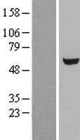ls007360 ugp2 human over expression lysates nm 006759 wb testing 1