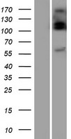 UGT2B10 Human Over-expression Lysates NM_001075