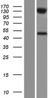 UGT2B10 Human Over-expression Lysates NM_001144767