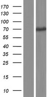 Uromucoid (UMOD) Human Over-expression Lysates NM_003361