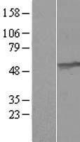 ls007372 umps human over expression lysates nm 000373 wb testing 1