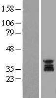 UNG Human Over-expression Lysates NM_003362
