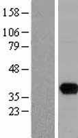 UNG Human Over-expression Lysates NM_080911