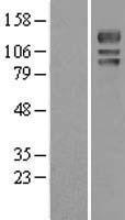 USP4 Human Over-expression Lysates NM_003363