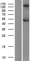 LXR beta (NR1H2) Human Over-expression Lysates NM_007121