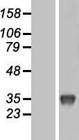 Uridine Phosphorylase 1 (UPP1) Human Over-expression Lysates NM_181597
