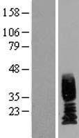 Uroplakin II (UPK2) Human Over-expression Lysates NM_006760