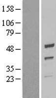 UQCRC2 Human Over-expression Lysates NM_003366