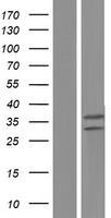 UQCRFS1 Human Over-expression Lysates NM_006003