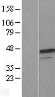 ls007389 urod human over expression lysates nm 000374 wb testing 1