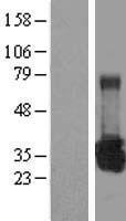 ls007390 uros human over expression lysates nm 000375 wb testing 1