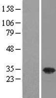 USF1 Human Over-expression Lysates NM_207005