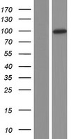 USP1 Human Over-expression Lysates NM_003368