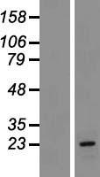 CLRN1 Human Over-expression Lysates NM_174878