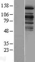 KDM6A Human Over-expression Lysates NM_021140