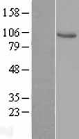 VAV1 Human Over-expression Lysates NM_005428