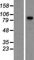 VCAM1 Human Over-expression Lysates NM_001078