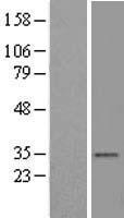 ls007417 vdac2 human over expression lysates nm 003375 wb testing 2