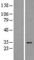 VDAC3 Human Over-expression Lysates NM_005662