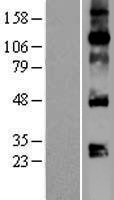 ls007422 vegfa human over expression lysates nm 001025366 wb testing 1