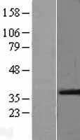 ls007422 vegfa human over expression lysates nm 001025370 wb testing 2