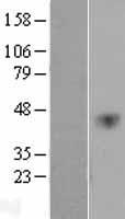 VEGFC Human Over-expression Lysates NM_005429
