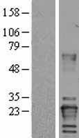 Von Hippel Lindau (VHL) Human Over-expression Lysates NM_000551