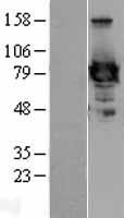 Ezrin (EZR) Human Over-expression Lysates NM_003379