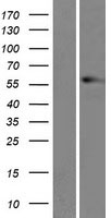 Vimentin (VIM) Human Over-expression Lysates NM_003380