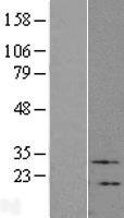 ls007432 vip human over expression lysates nm 003381 wb testing 1