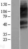 VPAC2 (VIPR2) Human Over-expression Lysates NM_003382