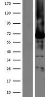 Bestrophin (BEST1) Human Over-expression Lysates NM_004183