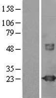 VILIP1 (VSNL1) Human Over-expression Lysates NM_003385