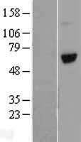 Vitronectin (VTN) Human Over-expression Lysates NM_000638