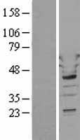 Tryptophanyl tRNA synthetase (WARS) Human Over-expression Lysates NM_004184