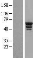Tryptophanyl tRNA synthetase (WARS) Human Over-expression Lysates NM_173701
