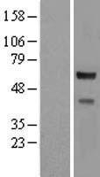 CORO2A Human Over-expression Lysates NM_052820