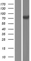 WHSC1 Human Over-expression Lysates NM_133334