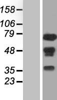 WHSC2 (NELFA) Human Over-expression Lysates NM_005663
