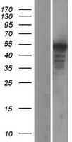 WNT5A Human Over-expression Lysates NM_003392
