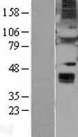 WNT6 Human Over-expression Lysates NM_006522