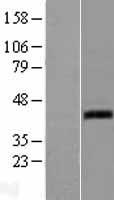 WNT7A Human Over-expression Lysates NM_004625
