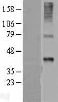 WNT7B Human Over-expression Lysates NM_058238